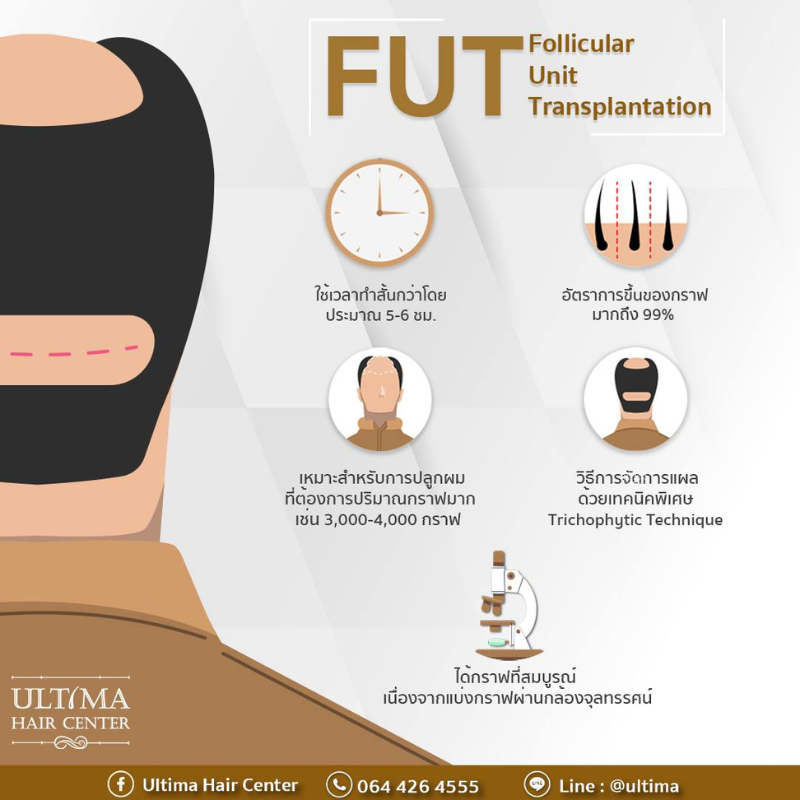 FUT