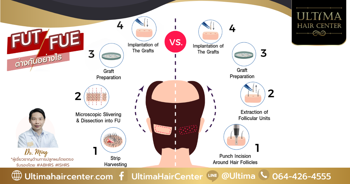 Ultima hair center