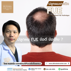 ปลูกผม FUE ข้อดี ข้อเสีย