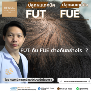 FUT กับ FUE ต่างกันอย่างไร