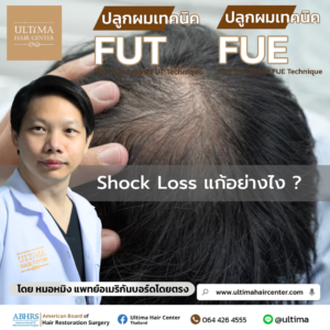 Shock Loss แก้อย่างไง