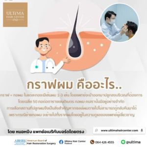 กราฟผม คืออะไร