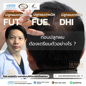 ก่อนปลูกผม ต้องเตรียมตัวอย่างไร