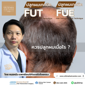 ควรปลูกผมเมื่อไร