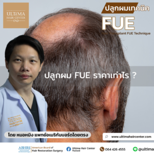 ปลูกผม FUE ราคาเท่าไร