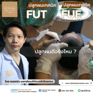 ปลูกผม ดีจริงไหม