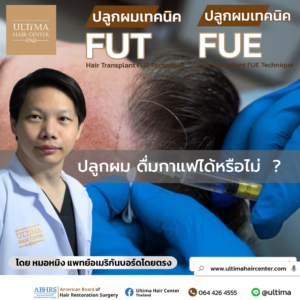 ปลูกผมดื่มกาแฟได้หรือไม่