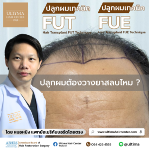 ปลูกผมต้องวางยาสลบไหม