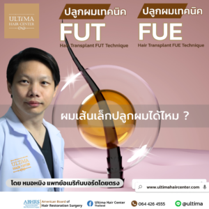 ผมเส้นเล็กปลูกผมได้ไหม