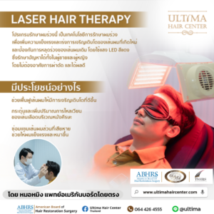 เลเซอร์ กระตุ้นรากผม