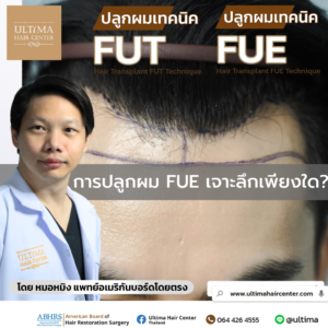 การปลูกผม FUE เจาะลึกเพียงใด