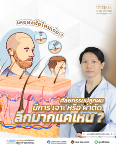 การปลูกผม เจาะ หรือ ผ่าตัดลึกมากแค่ไหน