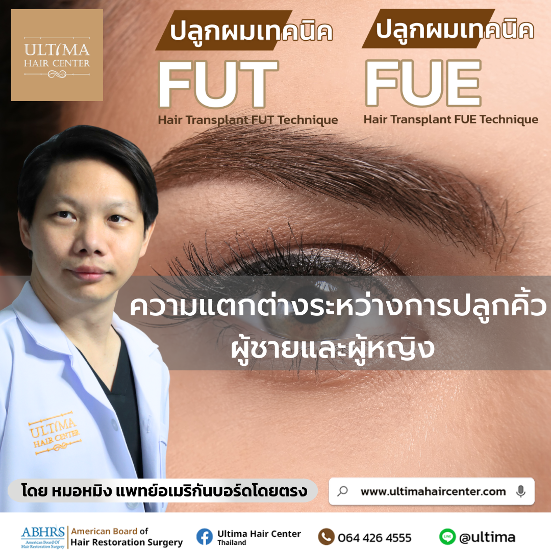  ความแตกต่างระหว่างการปลูกคิ้วผู้ชายและผู้หญิง