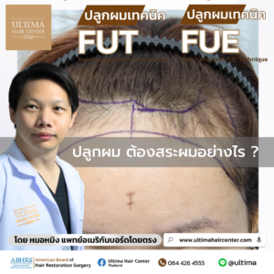 ปลูกผม ต้องสระผมอย่างไร