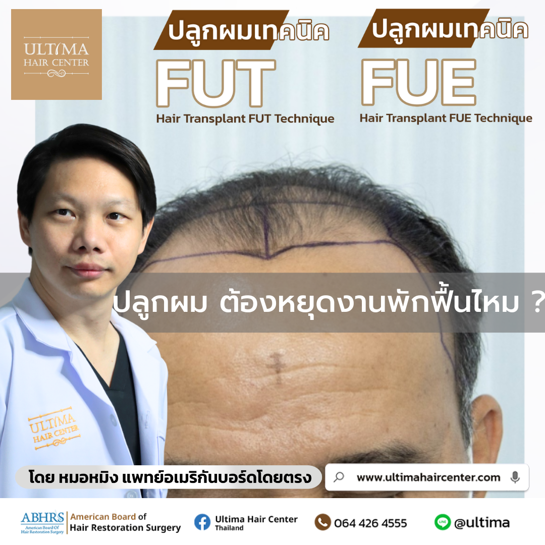 ปลูกผม ต้องหยุดงานพักฟื้นไหม
