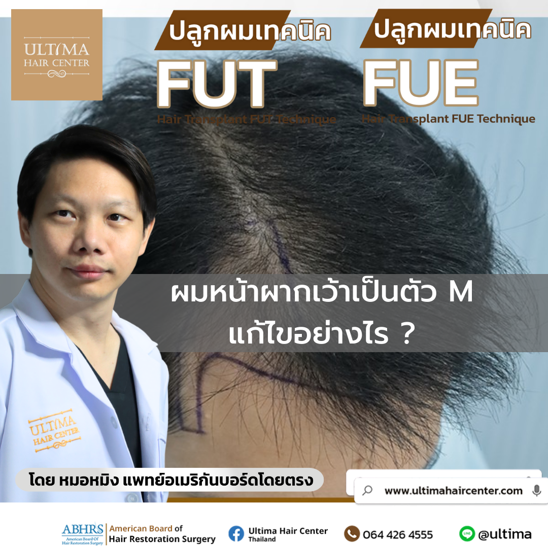 ผมหน้าผากเว้าเป็นตัว m แก้ไขอย่างไร