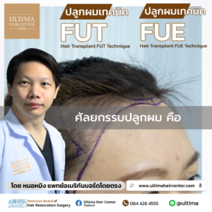 ศัลยกรรมปลูกผม คือ