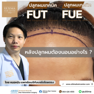 หลังปลูกผมต้องนอนอย่างไร