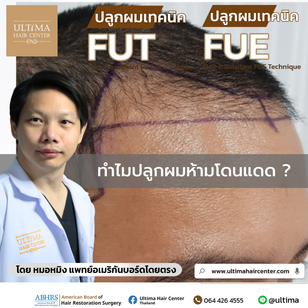 ทำไมปลูกผมห้ามโดนแดด ทำไมปลูกผมห้ามโดนแดด