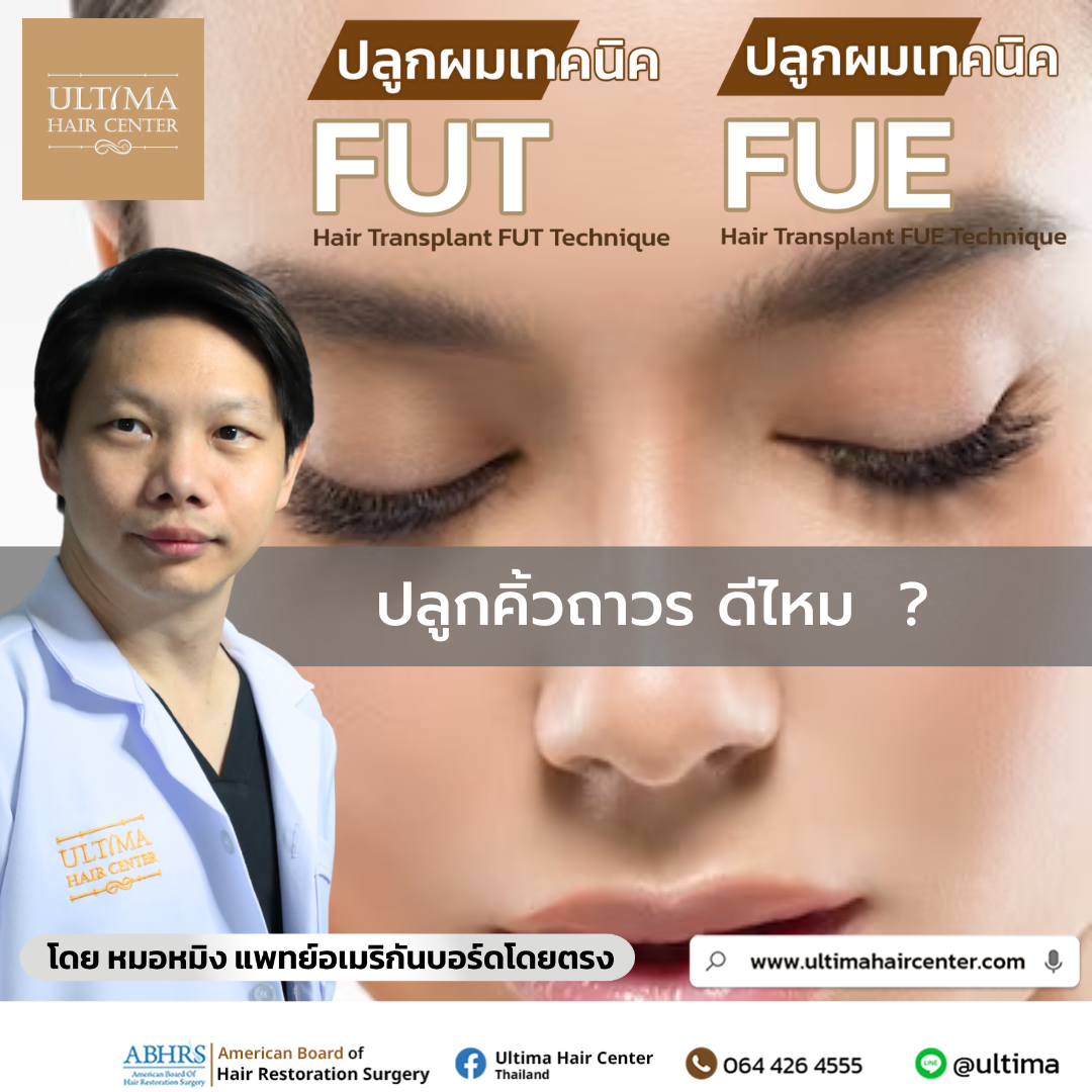 ปลูกคิ้วถาวร ดีไหม