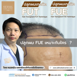 ปลูกผม FUE เหมาะกับใคร