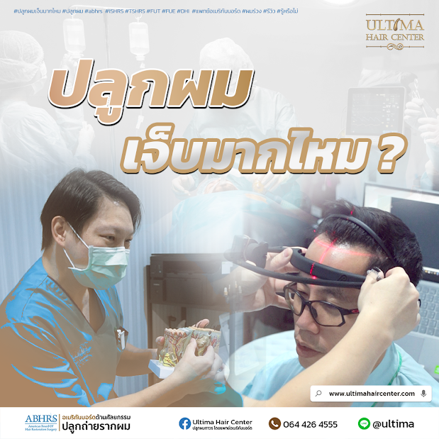 ปลูกผมเจ็บไหม