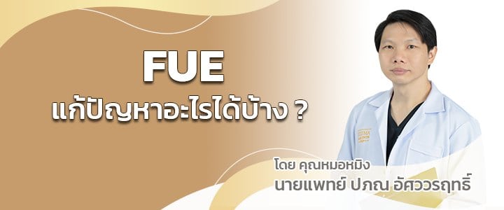FUE แก้ปัญหาอะไรได้บ้าง FUE แก้ปัญหาอะไรได้บ้าง