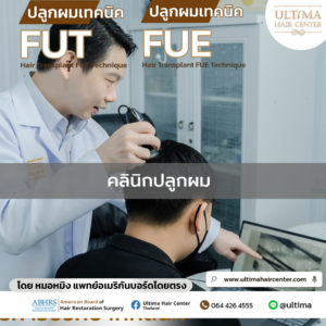 คลินิกปลูกผม