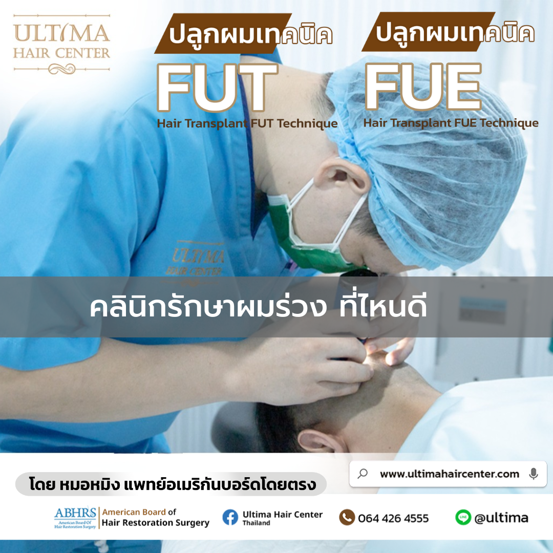 คลินิกรักษาผมร่วง