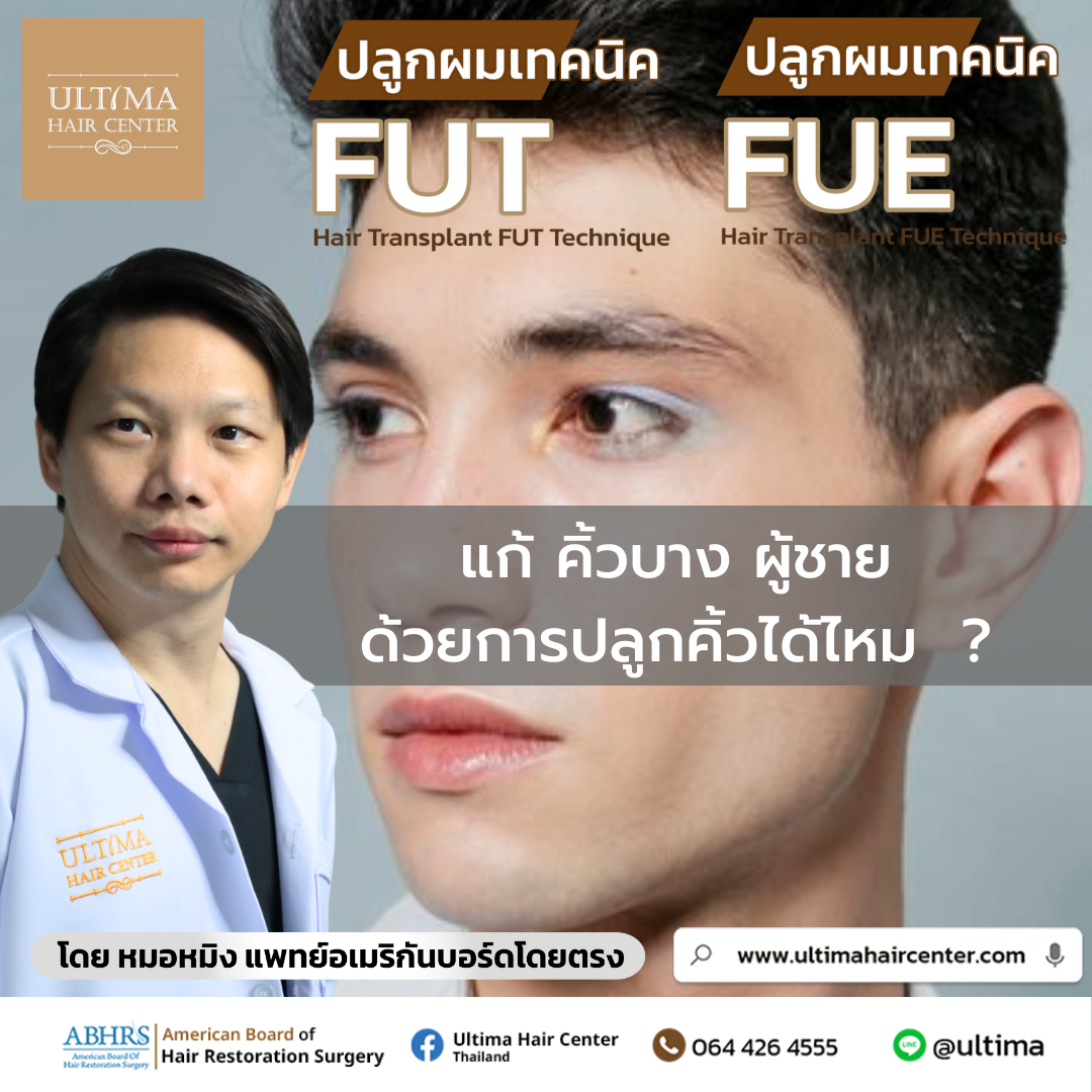 แก้ คิ้วบาง ผู้ชาย ด้วยการปลูกคิ้วได้ไหม 