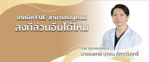เทคนิค FUE สามารถปลูกผมลงที่ส่วนอื่นได้ไหม