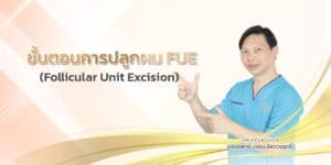 ขั้นตอนการปลูกผม FUE (Follicular Unit Excision)