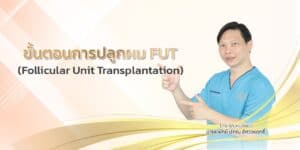 ขั้นตอนการปลูกผม FUT (Follicular Unit Transplantation)