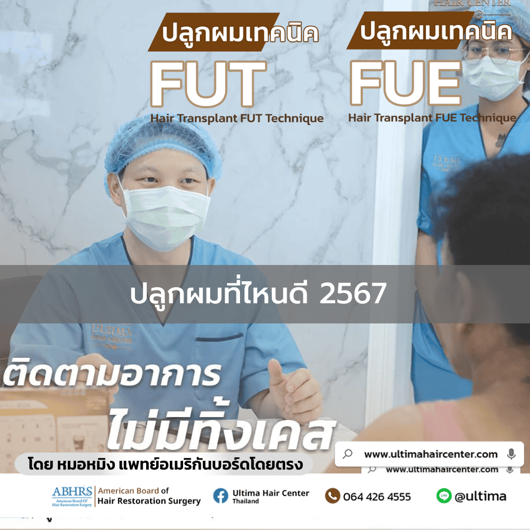 ปลูกผมที่ไหนดี 2567