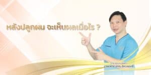 หลังปลูกผม จะเห็นผลเมื่อไร