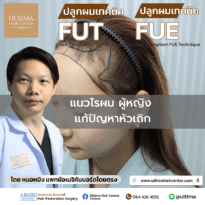 แนวไรผม ผู้หญิง แก้ปัญหาหัวเถิก