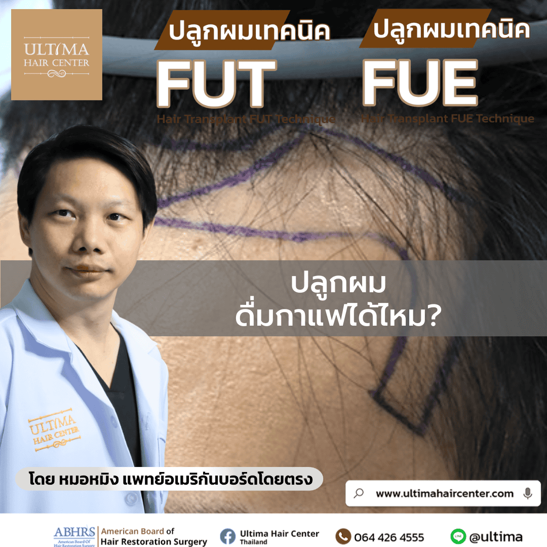 ปลูกผม ดื่มกาแฟได้ไหม