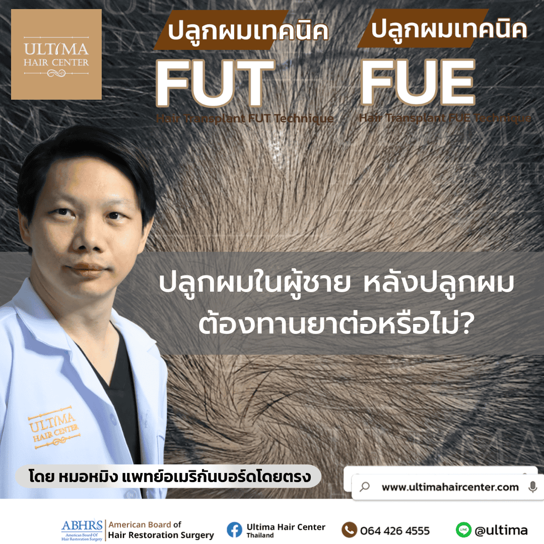 ปลูกผมในผู้ชาย หลังปลูกผม ต้องทานยาต่อหรือไม่