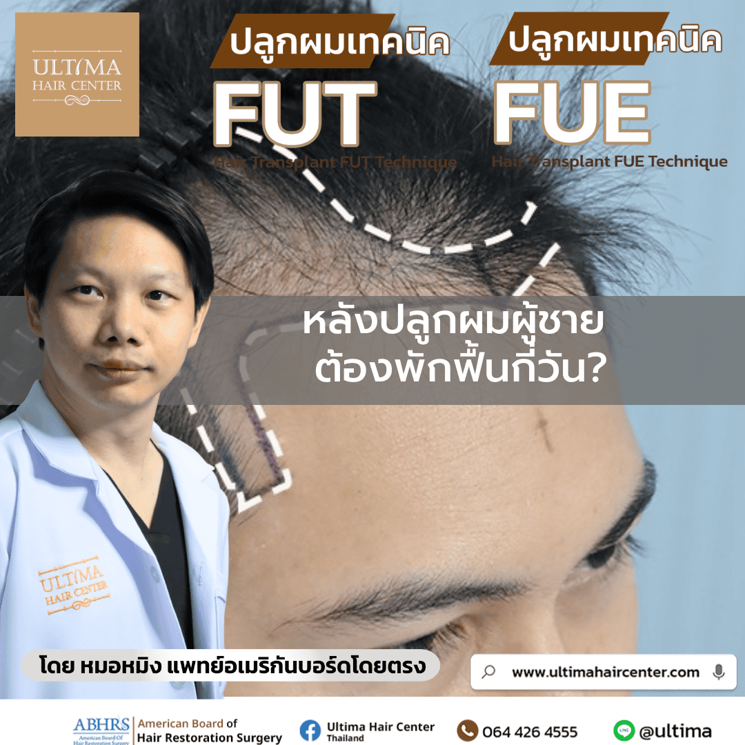 หลังปลูกผมผู้ชาย ต้องพักฟื้นกี่วัน