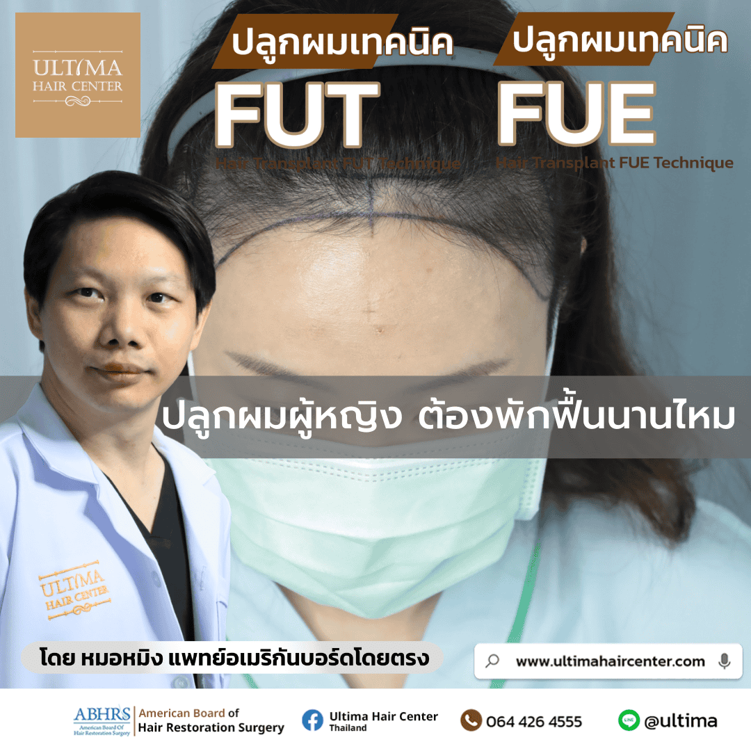 ปลูกผมต้องพักฟื้นนานไหม