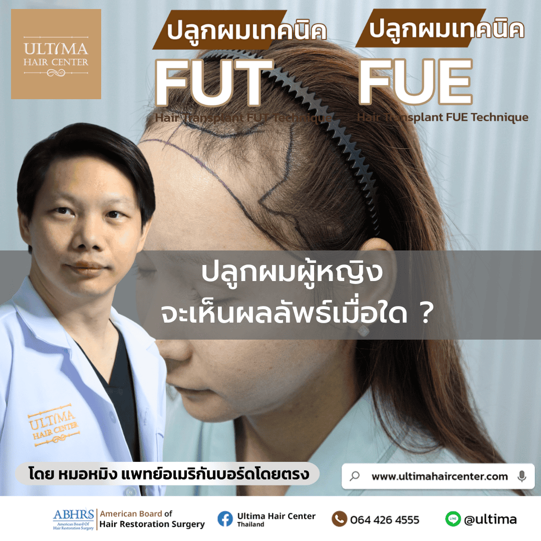 ปลูกผมผู้หญิง จะเห็นผลลัพธ์เมื่อใด