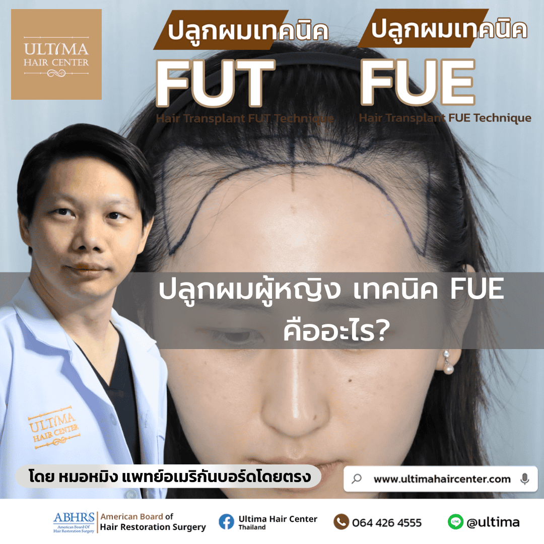 ปลูกผมผู้หญิง เทคนิค FUE คืออะไร