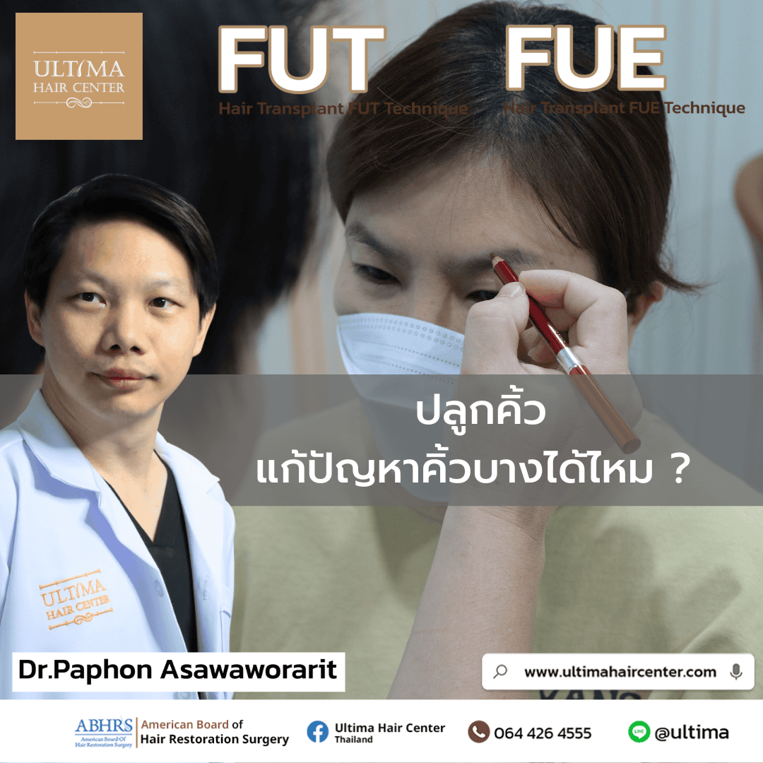 ปลูกคิ้วแก้ปัญหาคิ้วบางได้ไหม