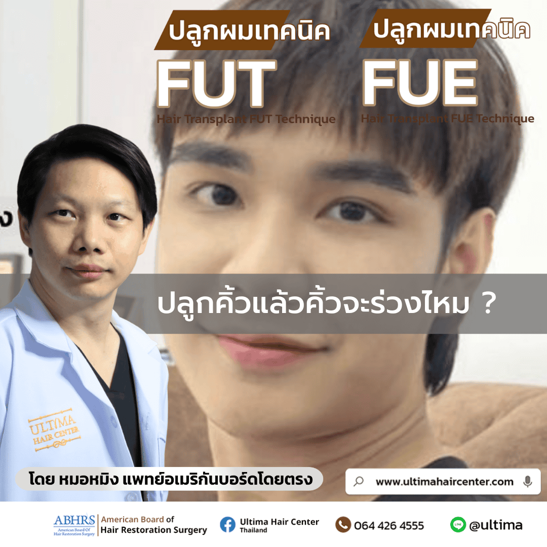 ปลูกคิ้วแล้วจะร่วงไหม? 