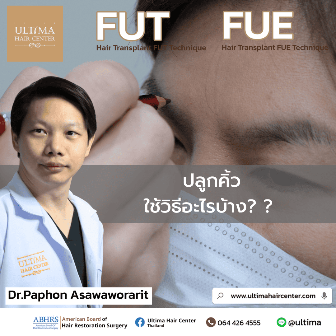 ปลูกคิ้วใช้วิธีอะไรบ้าง