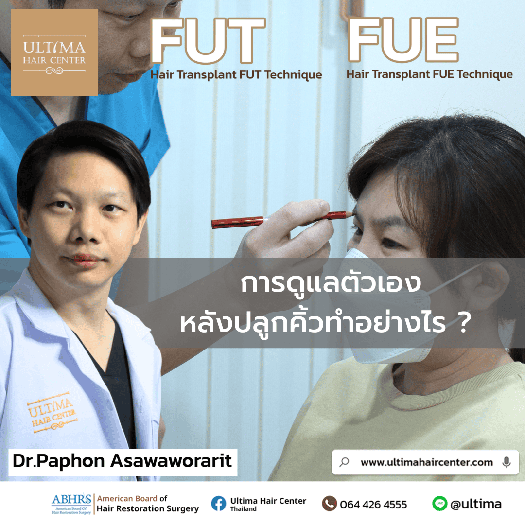ปลูกคิ้วใช้วิธีอะไรบ้าง