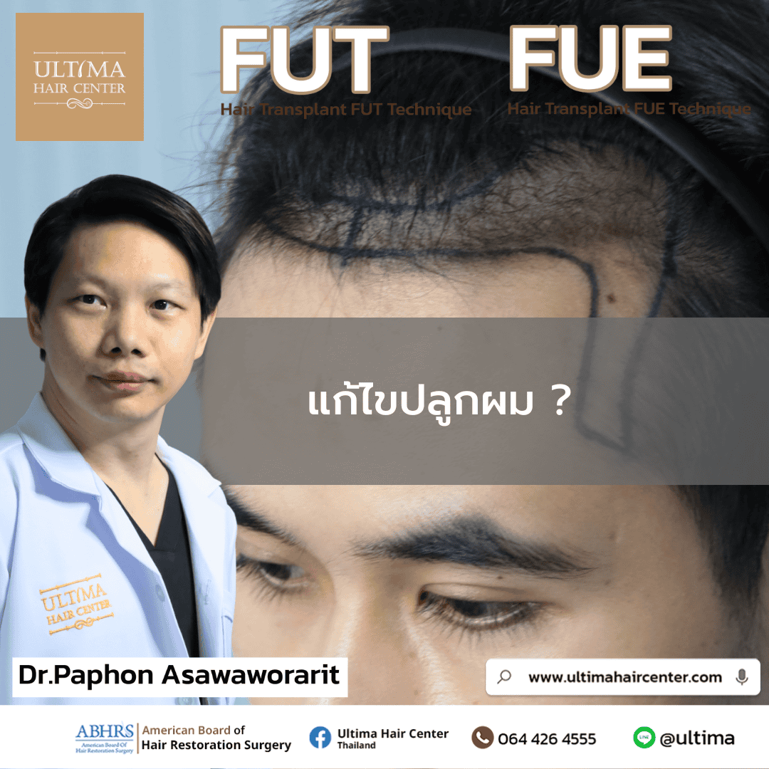 แก้ไขปลูกผม 