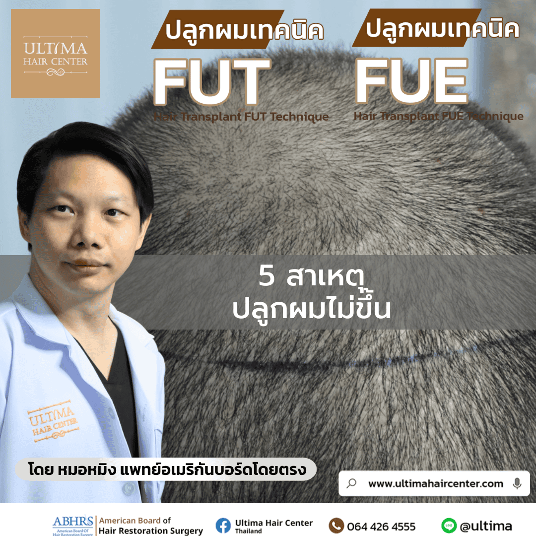 5 สาเหตุปลูกผมไม่ขึ้น