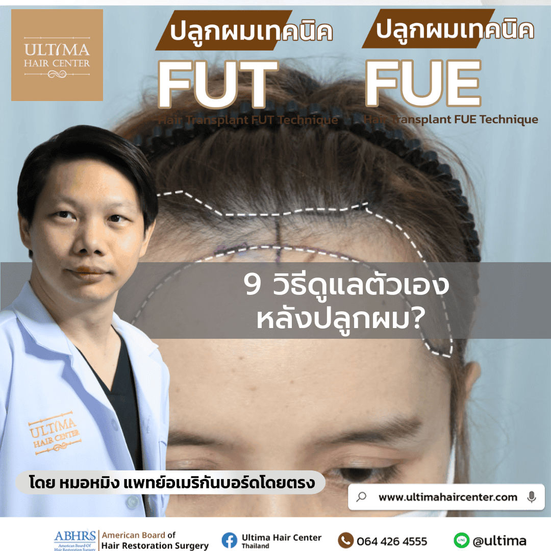 9 วิธีดูแลตัวเอง หลังปลูกผม  