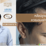 หลังปลูกผม ควรนอนอย่างไร